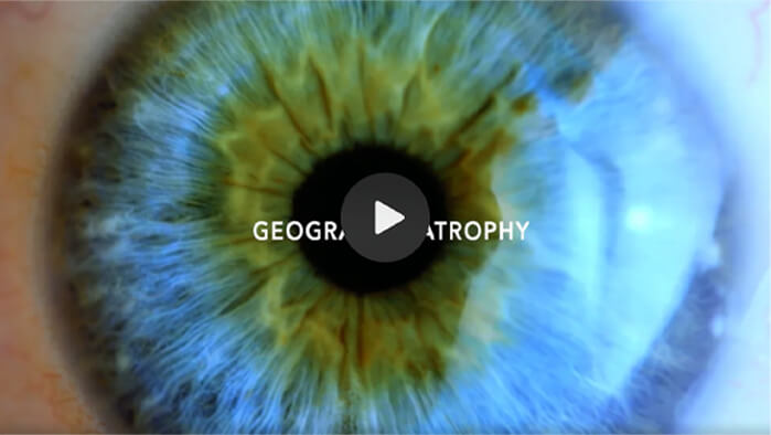 Image of an eye. Click to play video.